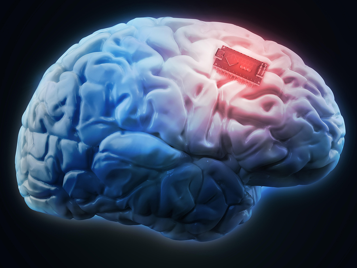 piracetam